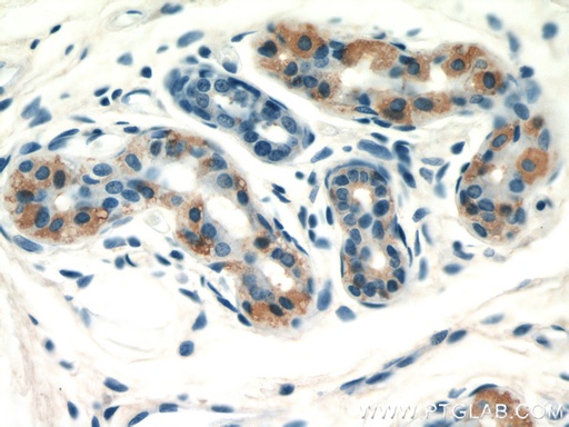 [55096-1-AP-20UL] GDI2 Polyclonal antibody