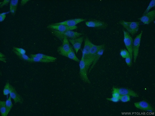 [55105-1-AP-150UL] MAGEA1 Polyclonal antibody