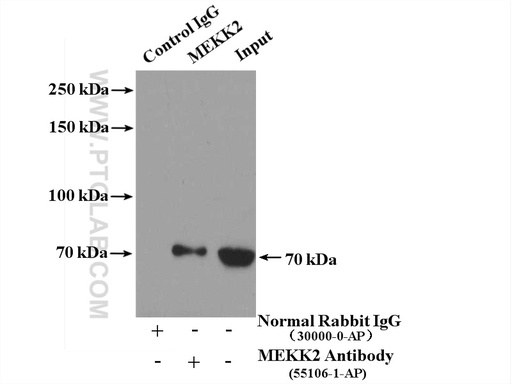[55106-1-AP-20UL] MEKK2 Polyclonal antibody