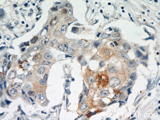 [55109-1-AP-150UL] MAGEA4 Polyclonal antibody
