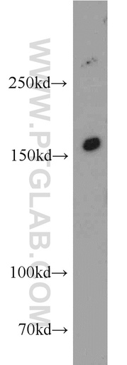 [55112-1-AP-20UL] INSRR Polyclonal antibody