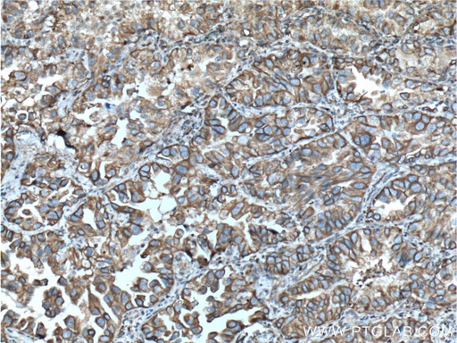 [55114-1-AP-20UL] NOTCH3 Polyclonal antibody