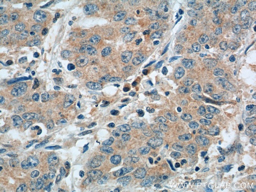 [55116-1-AP-20UL] NPR1 Polyclonal antibody