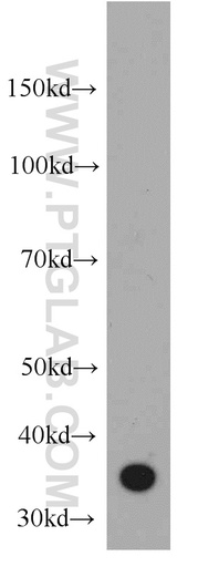 [55118-1-AP-20UL] CD336 Polyclonal antibody