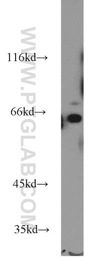 [55119-1-AP-20UL] WEE2 Polyclonal antibody