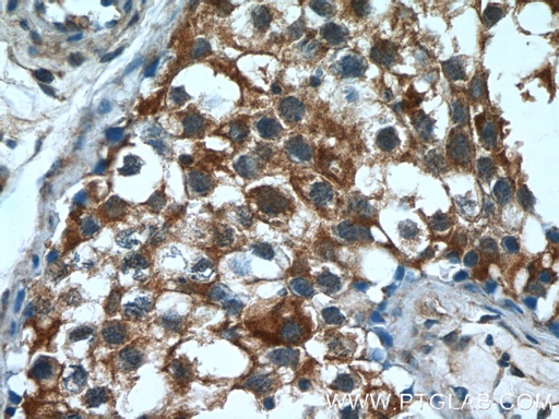 [55120-1-AP-150UL] PUMA Polyclonal antibody