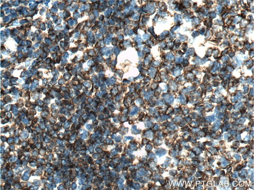 [55123-1-AP-150UL] PTPRJ Polyclonal antibody
