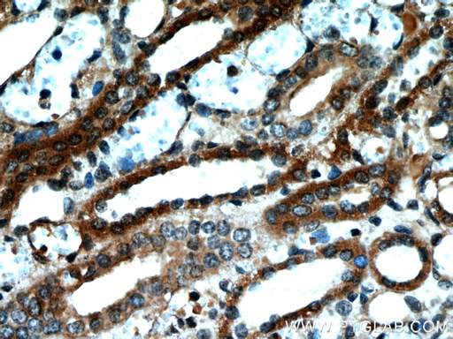[55126-1-AP-20UL] NUDT19 Polyclonal antibody