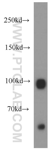[55127-1-AP-150UL] GUCY2D Polyclonal antibody