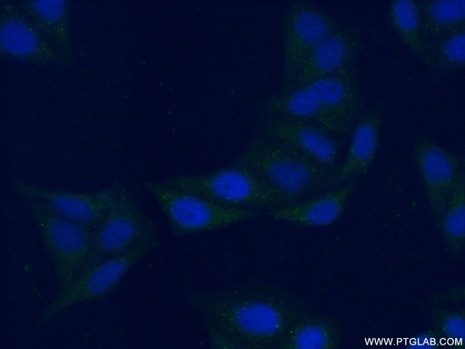 [55128-1-AP-20UL] PSAPL1 Polyclonal antibody