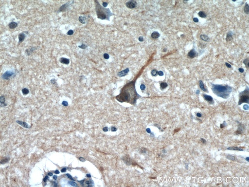 [55129-1-AP-150UL] PPP1R9B Polyclonal antibody