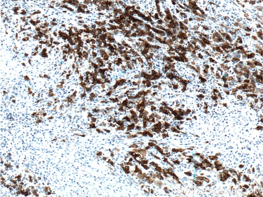 [55132-1-AP-20UL] CD30 Polyclonal antibody