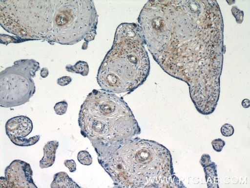 [55133-1-AP-20UL] S1PR1/EDG1 Polyclonal antibody