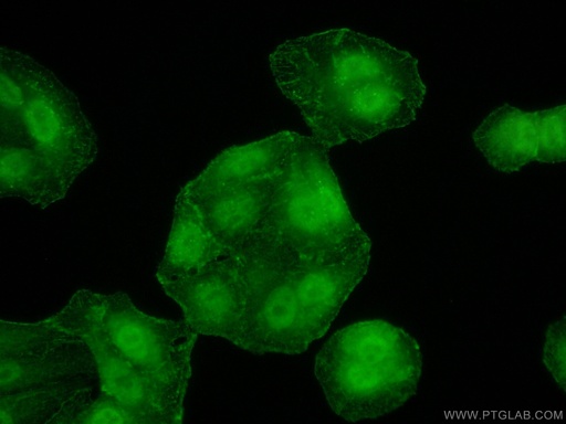 [55136-1-AP-150UL] PPP1CB Polyclonal antibody