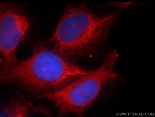 [55138-1-AP-20UL] PRKG2 Polyclonal antibody