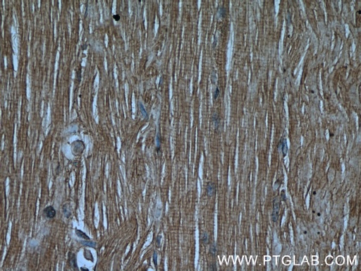 [55140-1-AP-150UL] CaMKII gamma-Specific Polyclonal antibody