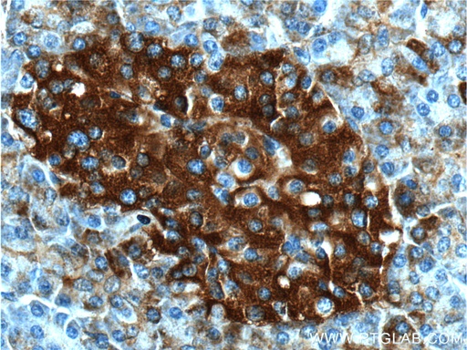 [55142-1-AP-150UL] AVPR1B Polyclonal antibody