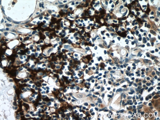 [55143-1-AP-20UL] PSMB11 Polyclonal antibody