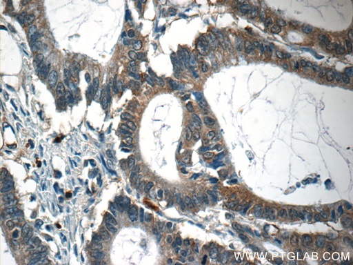 [55145-1-AP-150UL] CAPZA1 Polyclonal antibody