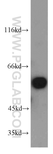 [55147-1-AP-150UL] PPP3CA-specific Polyclonal antibody