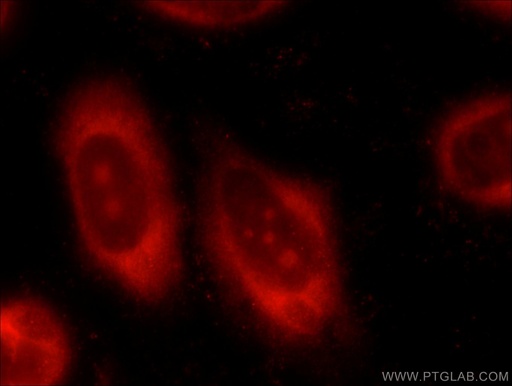 [55150-1-AP-150UL] PPP1CC Polyclonal antibody