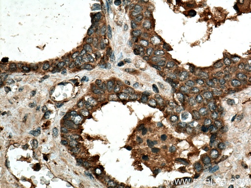 [55158-1-AP-150UL] IDUA Polyclonal antibody