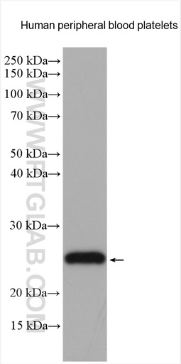 [55161-1-AP-150UL] CD42c Polyclonal antibody