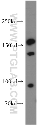[55162-1-AP-20UL] CD11d/Integrin Alpha D Polyclonal antibody