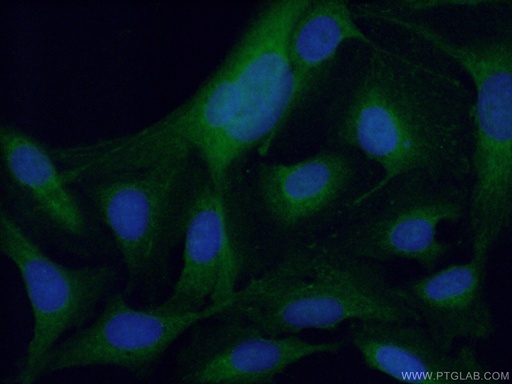 [55163-1-AP-150UL] PPP3CC-specific Polyclonal antibody