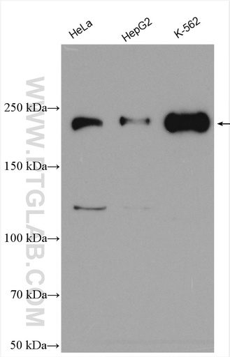 [55165-1-AP-20UL] ARHGAP5 Polyclonal antibody