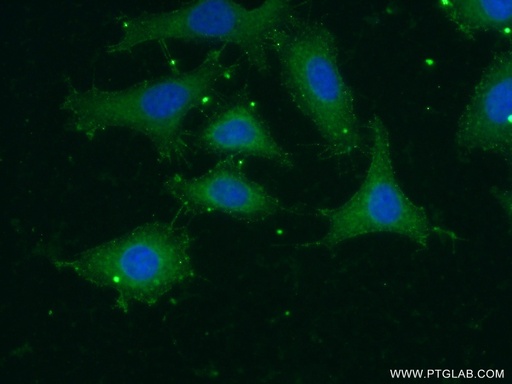 [55167-1-AP-150UL] GNAT1 Polyclonal antibody