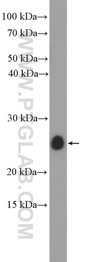 [55169-1-AP-150UL] IL-11 Polyclonal antibody