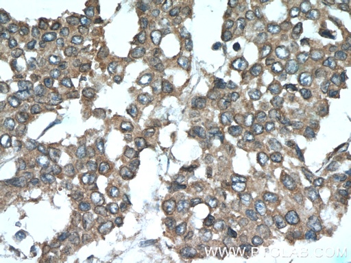 [55175-1-AP-150UL] SMURF1 Polyclonal antibody