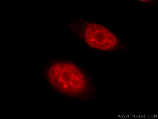 [55178-1-AP-20UL] THOC2 Polyclonal antibody