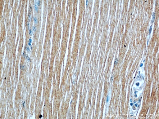 [55179-1-AP-20UL] ATP1A2-Specific Polyclonal antibody