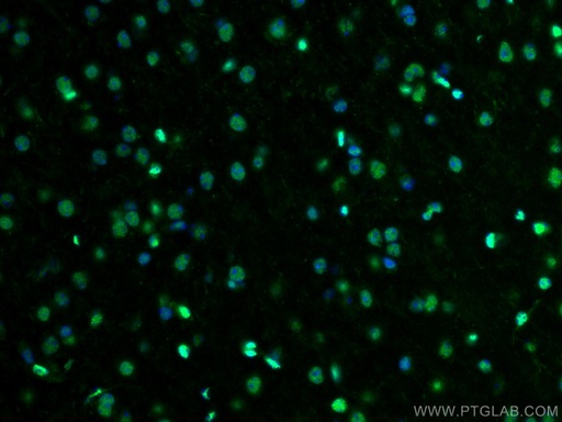 [55181-1-AP-20UL] PTBP1 Polyclonal antibody