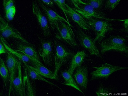 [55182-1-AP-20UL] p150 glued Polyclonal antibody