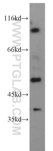 [55183-1-AP-20UL] PDE6C Polyclonal antibody