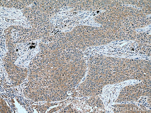 [55184-1-AP-20UL] WNT5A/B Polyclonal antibody