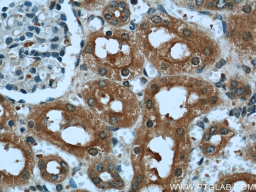 [55185-1-AP-150UL] DARC Polyclonal antibody