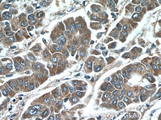 [55189-1-AP-150UL] IQGAP2 Polyclonal antibody