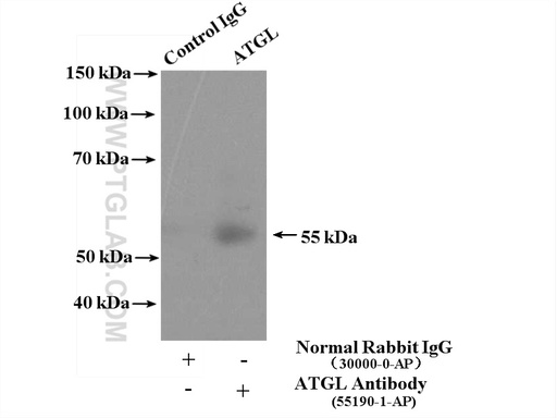 [55190-1-AP-20UL] ATGL Polyclonal antibody
