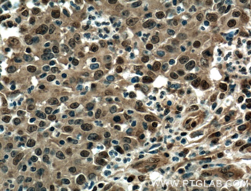 [55191-1-AP-20UL] EWS Polyclonal antibody