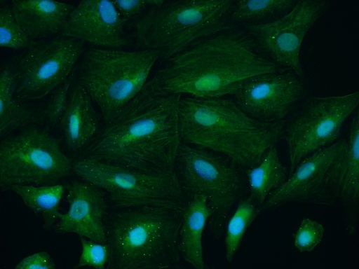 [55192-1-AP-20UL] CSNK1A1 Polyclonal antibody
