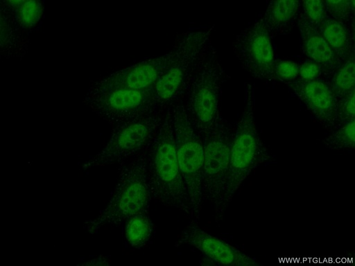 [55195-1-AP-20UL] CPSF7 Polyclonal antibody