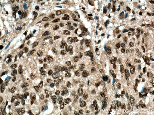 [55200-1-AP-150UL] MBD2 Polyclonal antibody
