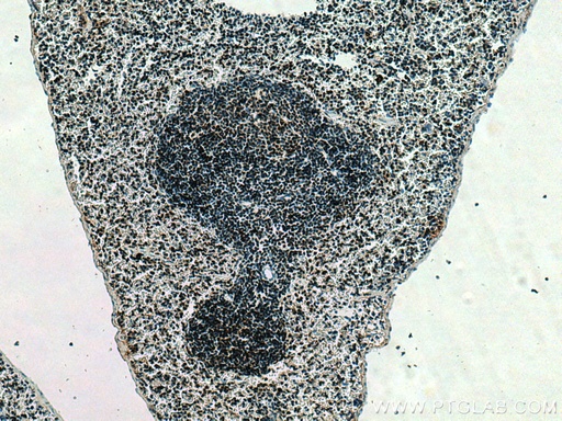 [55201-1-AP-20UL] SET/TAF-I Polyclonal antibody