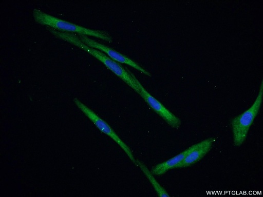 [55205-1-AP-20UL] IGFBP5 Polyclonal antibody