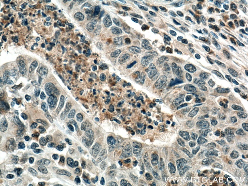 [55206-1-AP-20UL] PCSK9 Polyclonal antibody