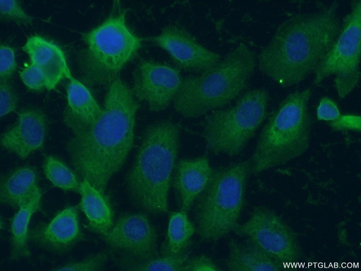 [55208-1-AP-150UL] L-Plastin Polyclonal antibody